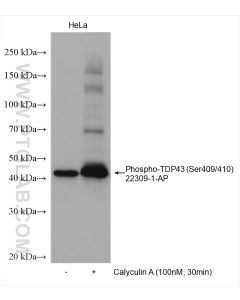 Phospho-TDP43 (Ser409/410) Polyclonal antibody proteintech 22309-1-AP