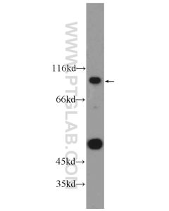 ANKRD6 Polyclonal antibody proteintech 24333-1-AP