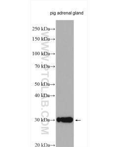 STAR Polyclonal antibody proteintech 12225-1-AP