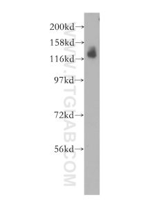 SLC4A4 Polyclonal antibody proteintech 11885-1-AP