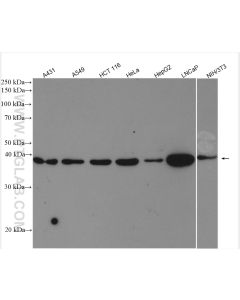 ABHD5 Polyclonal antibody proteintech 12201-1-AP