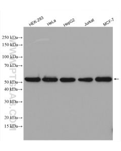 SHMT2 Polyclonal antibody proteintech 11099-1-AP