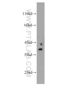 MRPS22 Polyclonal antibody proteintech 10984-1-AP