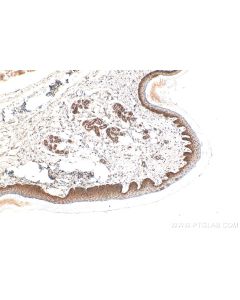 Loricrin Polyclonal antibody proteintech 55439-1-AP
