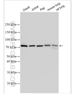 GCLC Polyclonal antibody proteintech 12601-1-AP