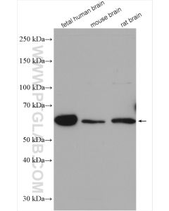 TCTN1 Polyclonal antibody proteintech 15004-1-AP