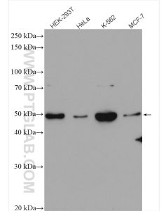 Chk1 Polyclonal antibody proteintech 25887-1-AP