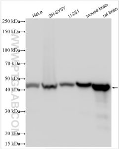 NSE Polyclonal antibody proteintech 10149-1-AP