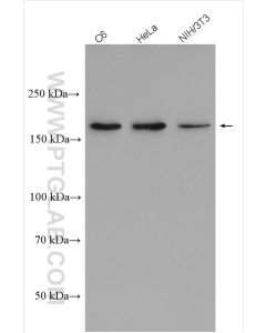 Thrombospondin 1 Polyclonal antibody proteintech 18304-1-AP