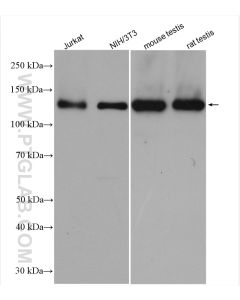 DNMT3A Polyclonal antibody proteintech 20954-1-AP