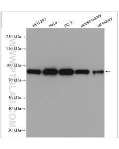 DDX1 Polyclonal antibody proteintech 11357-1-AP