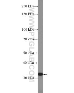 CHMP2A Polyclonal antibody proteintech 10477-1-AP