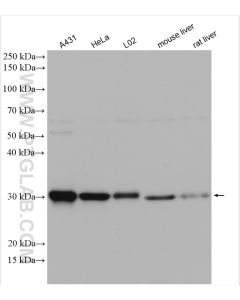 GCLM Polyclonal antibody proteintech 14241-1-AP