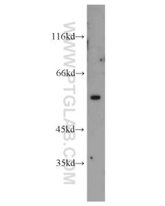 Vimentin Polyclonal antibody proteintech 22031-1-AP