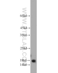 PIN1 Polyclonal antibody proteintech 10495-1-AP