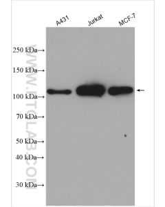 RB1 Polyclonal antibody proteintech 10048-2-Ig