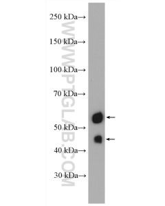PAX8 Polyclonal antibody proteintech 10336-1-AP