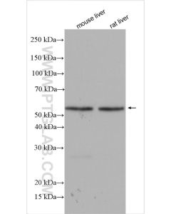 GCK Polyclonal antibody proteintech 19666-1-AP