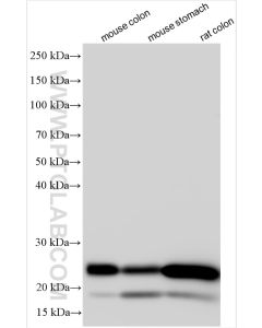 transgelin/SM22 Polyclonal antibody proteintech 10493-1-AP