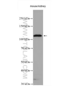 ACE2 Polyclonal antibody proteintech 21115-1-AP