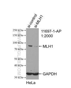 MLH1 Polyclonal antibody proteintech 11697-1-AP