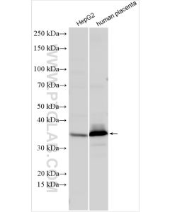 HSD17B2 Polyclonal antibody proteintech 10978-1-AP
