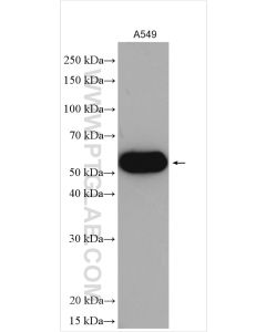 ALDH3A1 Polyclonal antibody proteintech 15578-1-AP
