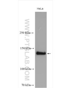 NBR1 Polyclonal antibody proteintech 16004-1-AP