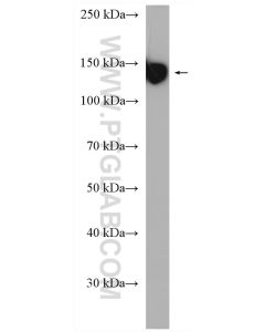 CD42b Polyclonal antibody proteintech 12860-1-AP