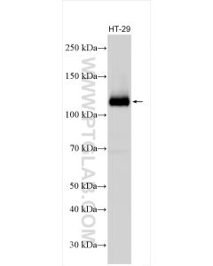 EPHB4 Polyclonal antibody proteintech 20883-1-AP