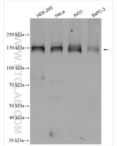 ASK1 Polyclonal antibody proteintech 28201-1-AP