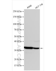 MTHFD2 Polyclonal antibody proteintech 12270-1-AP