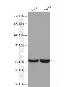 CYP51A1 Polyclonal antibody proteintech 13431-1-AP