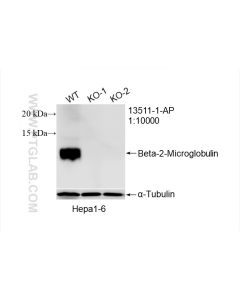 Beta-2-Microglobulin Polyclonal antibody proteintech 13511-1-AP