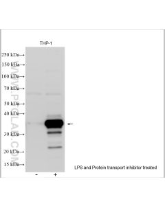 IL-1 beta Polyclonal antibody proteintech 16806-1-AP
