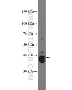 SOX2 Polyclonal antibody proteintech 11064-1-AP