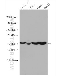 ATPB Polyclonal antibody proteintech 17247-1-AP