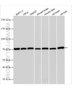 GRP78/BIP Polyclonal antibody proteintech 11587-1-AP