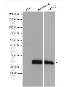 SFTPC Polyclonal antibody proteintech 10774-1-AP