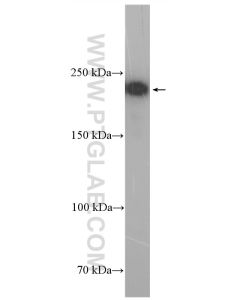 REST Polyclonal antibody proteintech 22242-1-AP