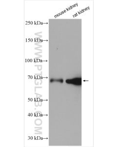 TORC2 Polyclonal antibody proteintech 12497-1-AP