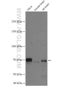 OPTN/Optineurin Polyclonal antibody proteintech 10837-1-AP