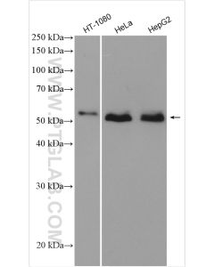 SMAD1 Polyclonal antibody proteintech 10429-1-AP