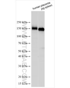 CD163 Polyclonal antibody proteintech 16646-1-AP
