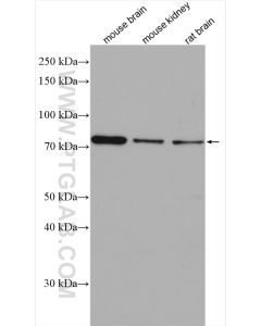 PRKG1 Polyclonal antibody proteintech 21646-1-AP