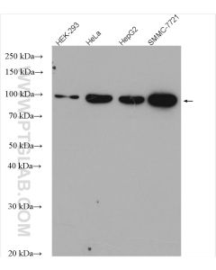 golgin 97 Polyclonal antibody proteintech 12640-1-AP