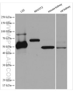 ARL13B Polyclonal antibody proteintech 17711-1-AP