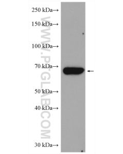 CHEK2 Polyclonal antibody proteintech 13954-1-AP