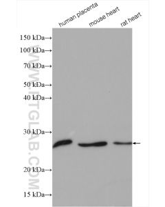 CLPP Polyclonal antibody proteintech 15698-1-AP
