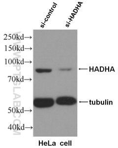 HADHA Polyclonal antibody proteintech 10758-1-AP